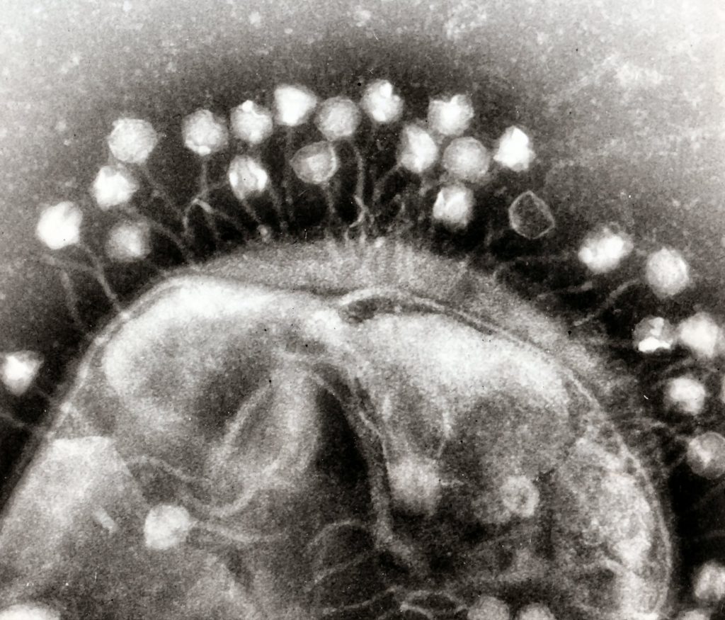 Electron micrograph of bacteriophage clustering around a bacterium.