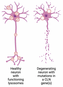cartoon of two neurons side-by-side, one healthy and intact, one broken into little pieces.